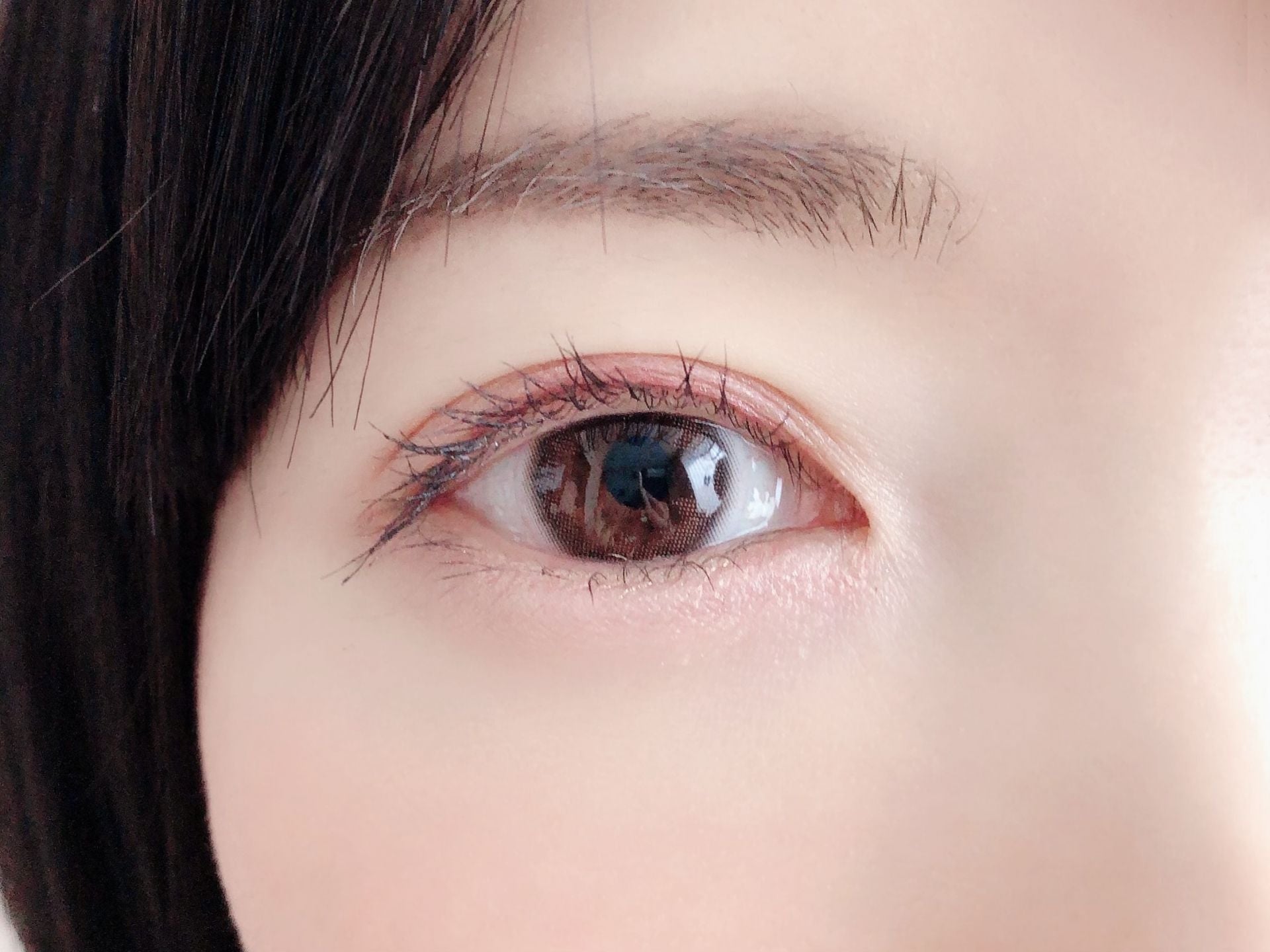 加齢黄斑変性とは？失明までの期間