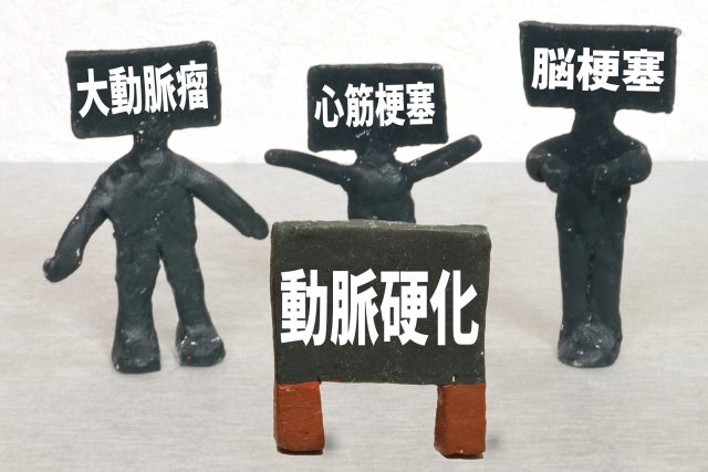心筋梗塞の前兆の症状とは？原因や予防法を解説