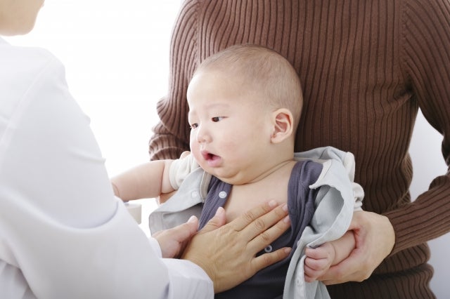 乳児湿疹で受診している赤ちゃんのイメージ写真