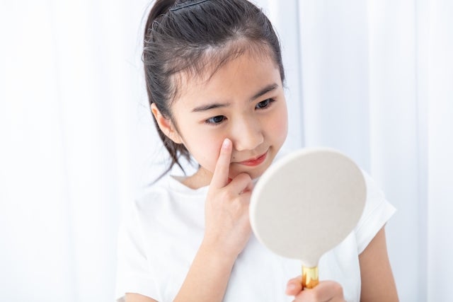 【赤ちゃんのスキンケア】まずは5つの基本をマスター！：4. 赤ちゃんのスキンケアはいつまで必要？