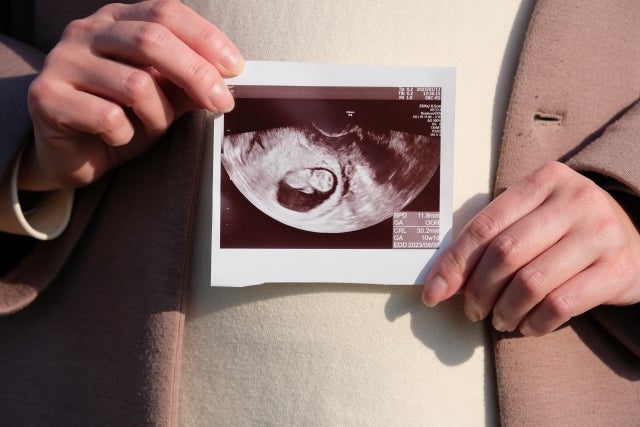 赤ちゃんの性別が決まるのは受精のとき、そしてわかるのは妊娠中期頃。 男の子は14～15週頃、女の子は17～18週頃に判定できることが多いです。