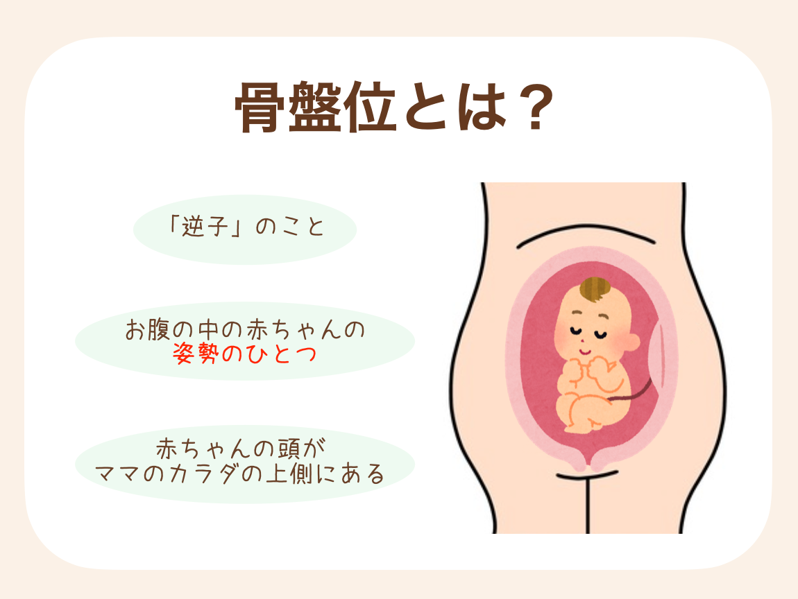 「骨盤位」とは、お腹の中の赤ちゃんの姿勢のひとつ。赤ちゃんの頭がママのカラダの上側（頭側）に頭がある状態。