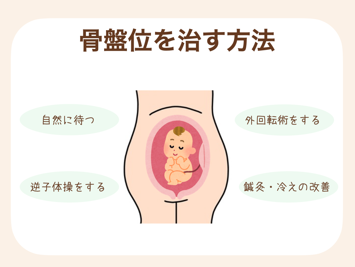 自然に待つ、外回転術をする、逆子体操をする、鍼灸・冷えの改善