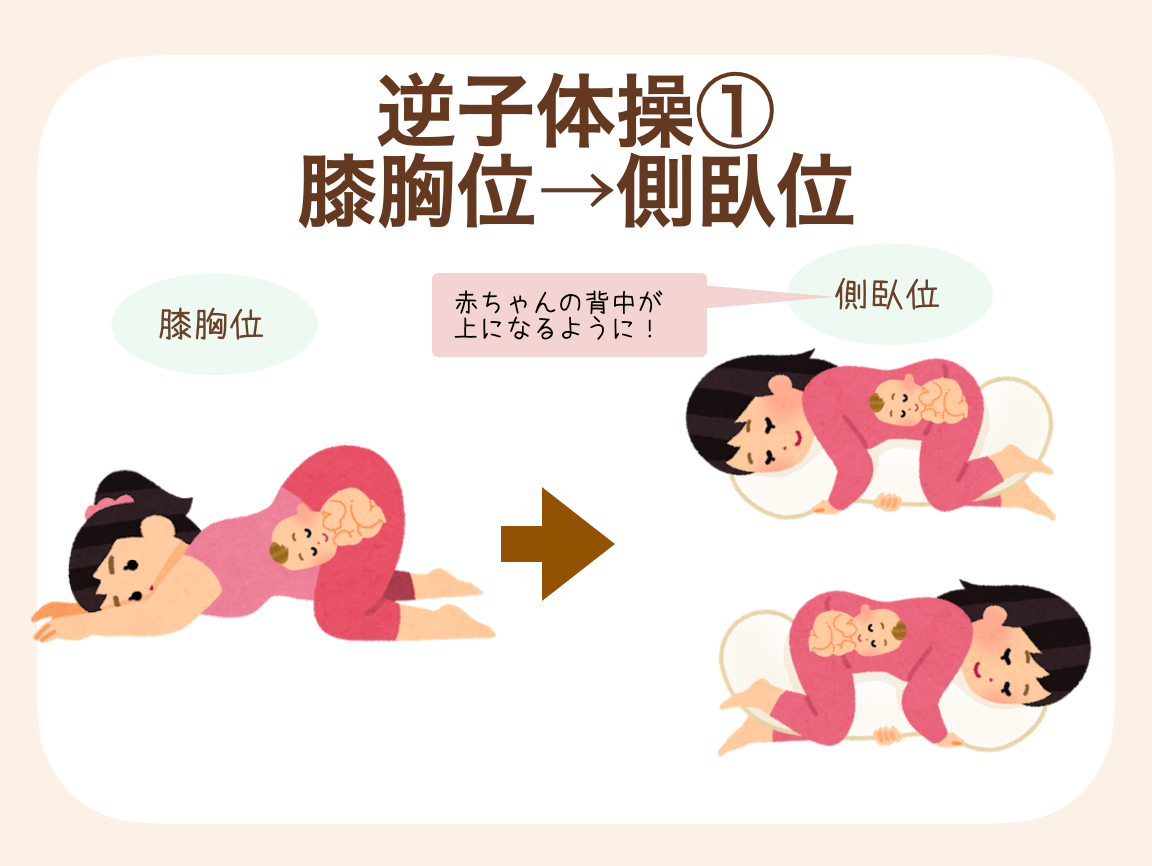 膝胸位（胸と膝を近づけ、お尻が高く持ち上がった姿勢）から側臥位（横向きの姿勢）になる方法