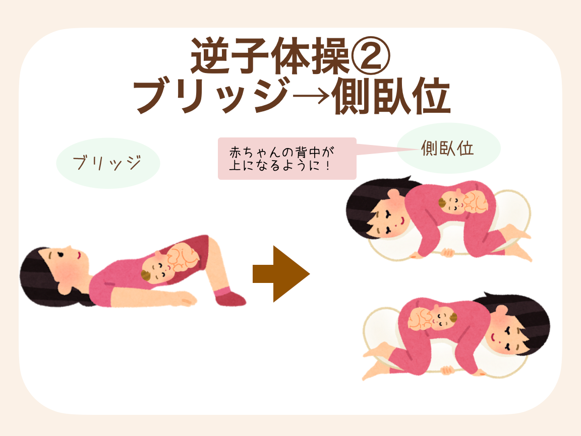 お尻を高くあげたブリッジの姿勢から側臥位（横向きの姿勢）になる方法
