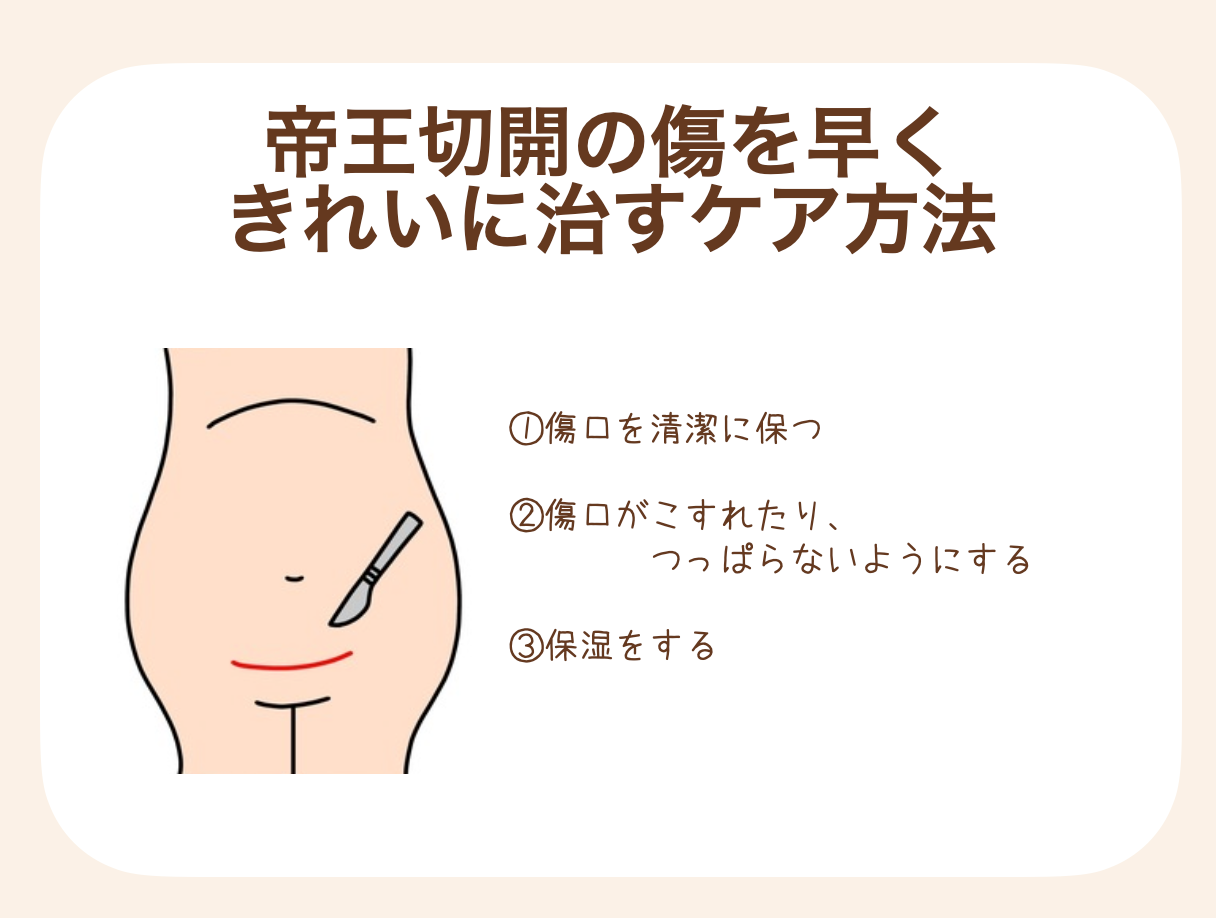 帝王切開後の傷のケアは、手術後早い時期から始めていきましょう