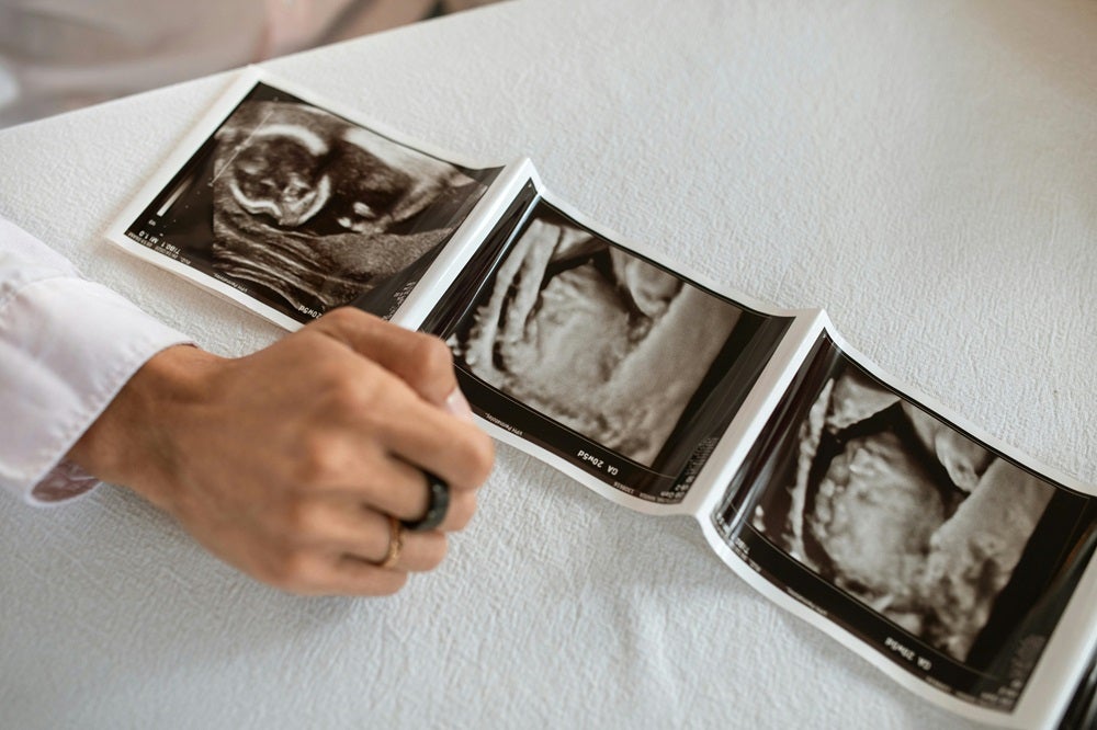 着床出血とは、受精卵が子宮内膜に着床した時に起こる出血のこと