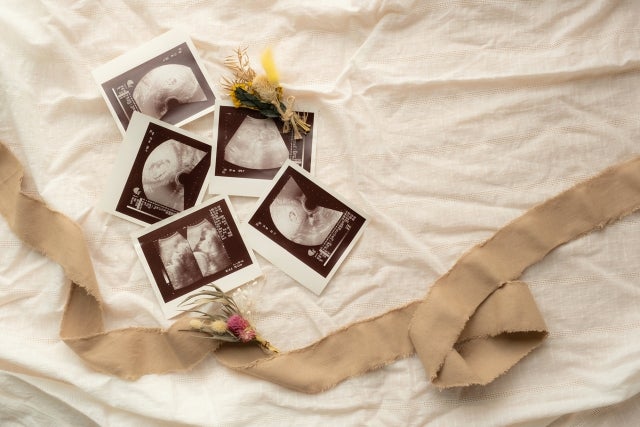 妊婦さんの体が冷えやすい原因の2つ目は、ホルモンバランスの変化です。