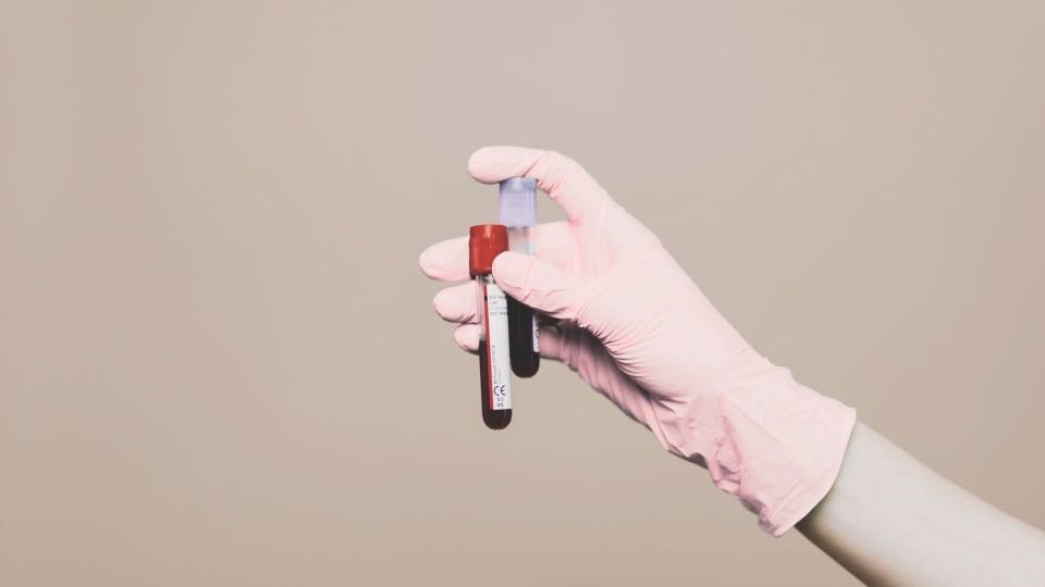 免疫・血液・ホルモンに問題があると着床率が下がります