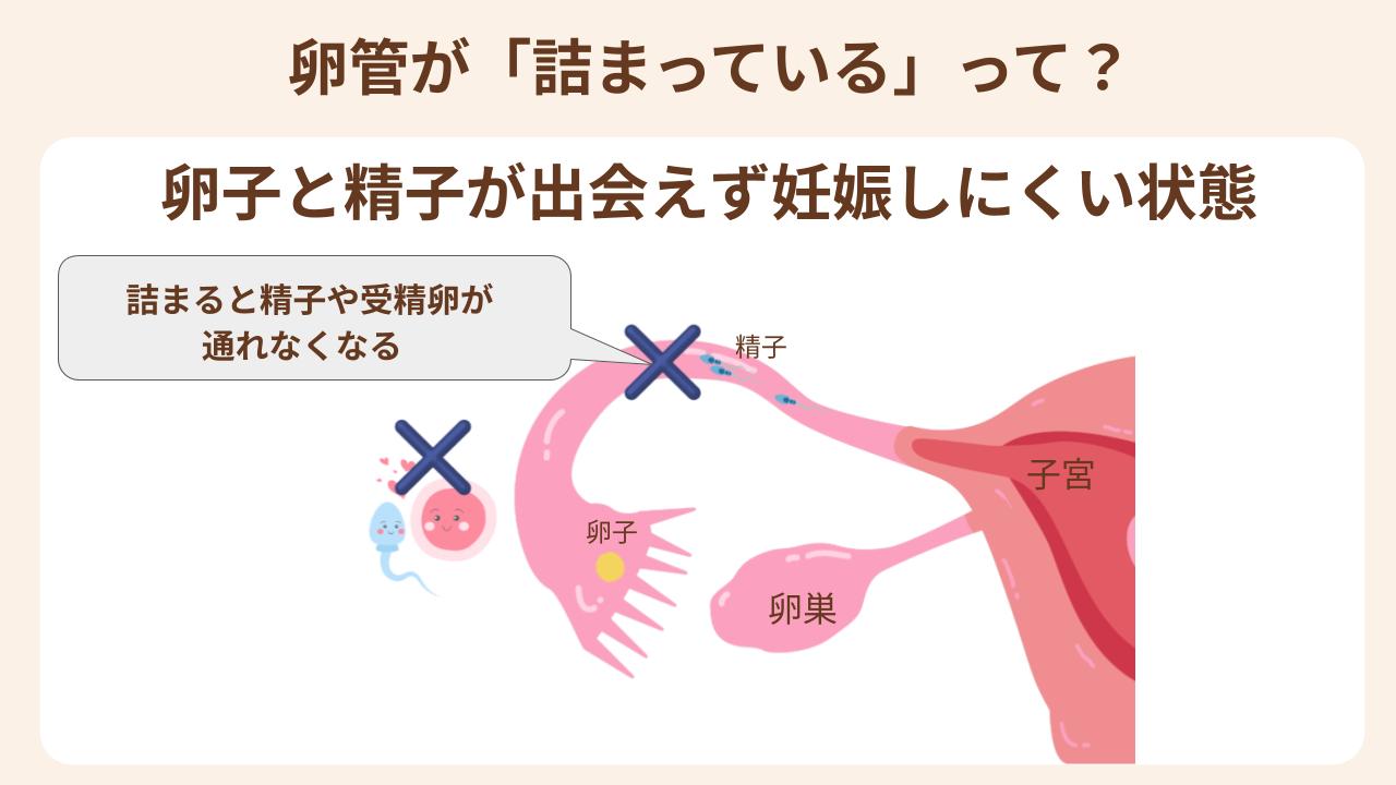 粟åãšåµåãåºäŒããåŠåš ãã«ããç¶æ
