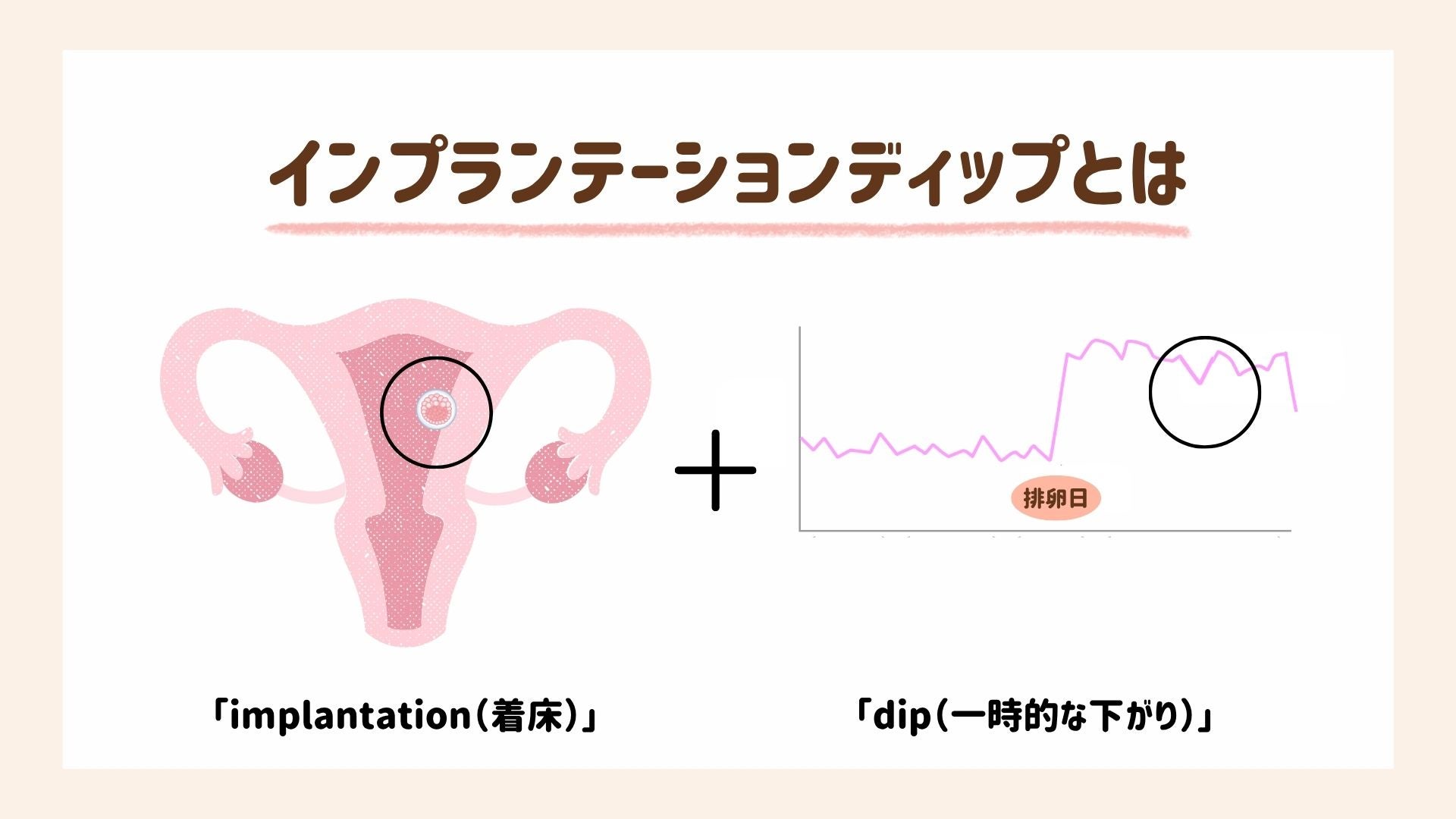 イン プランテーション ディップ