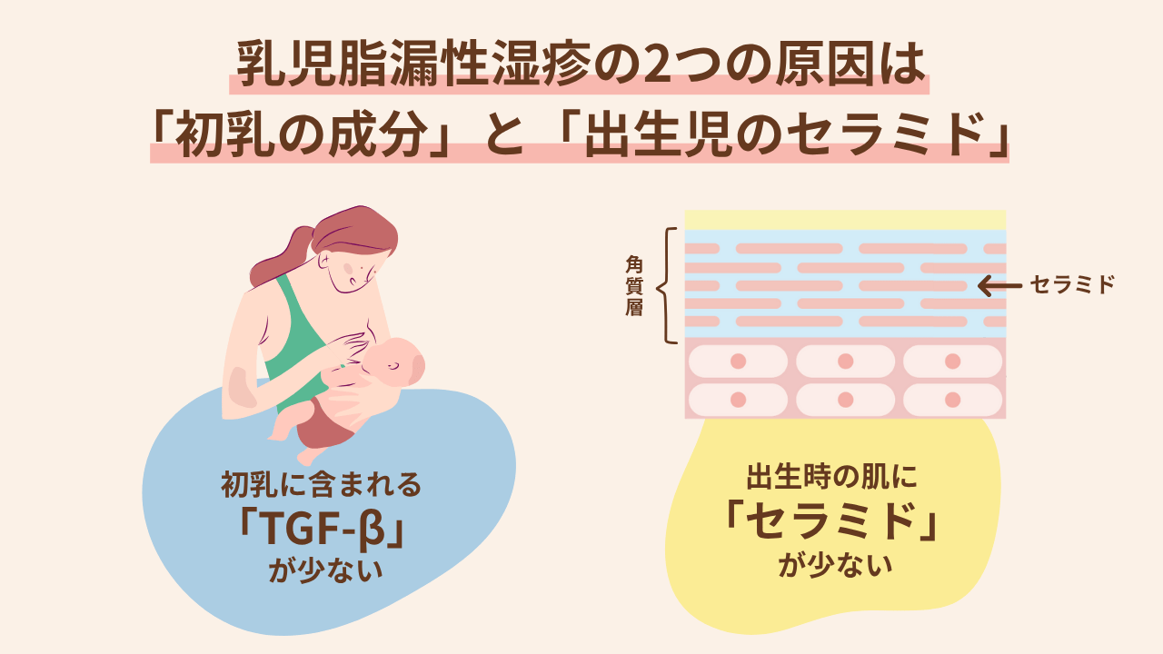 国立成育医療研究センターによる最新の研究で、乳児脂漏性湿疹になりやすい赤ちゃんには、さらに2つの特徴があることがわかってきました