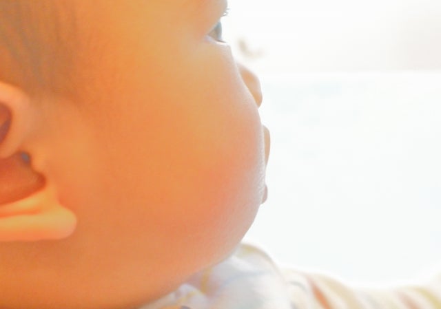 乳児湿疹の主な原因:皮脂の過剰な分泌