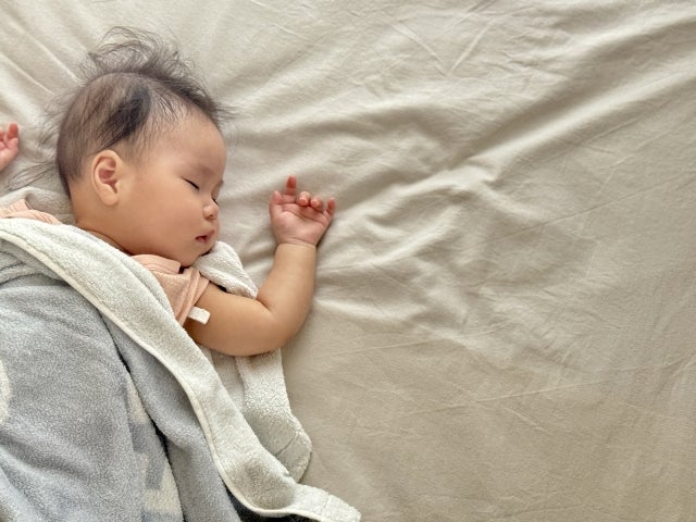 乳児湿疹はいつから?いつまで出るの?