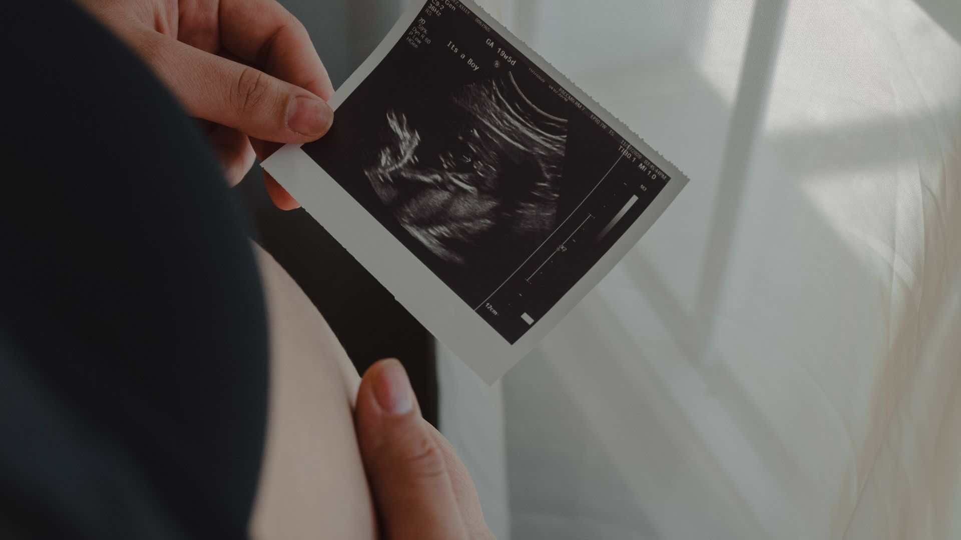 高齢出産による母子へのリスクを紹介