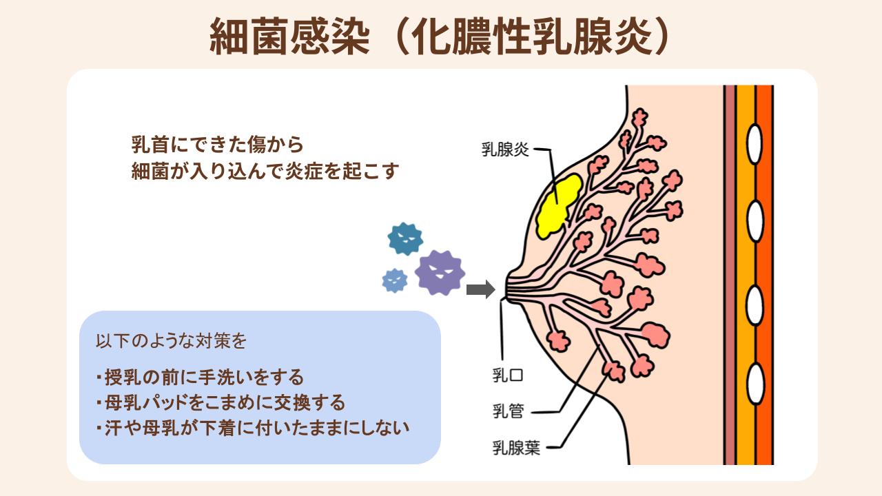 化膿性乳腺炎は、乳首にできた小さな傷から、菌が入り込んで炎症を起こした状態