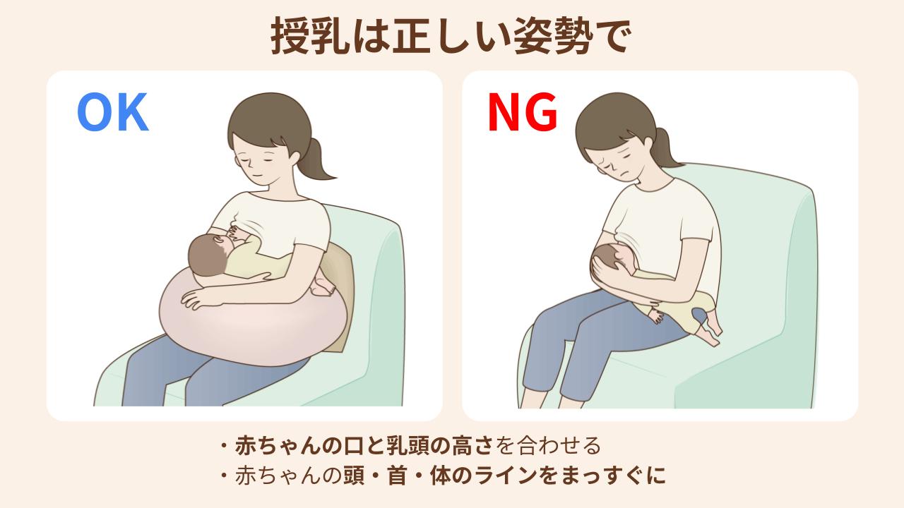 乳腺炎を予防するために気をつけたい授乳姿勢のポイントを紹介