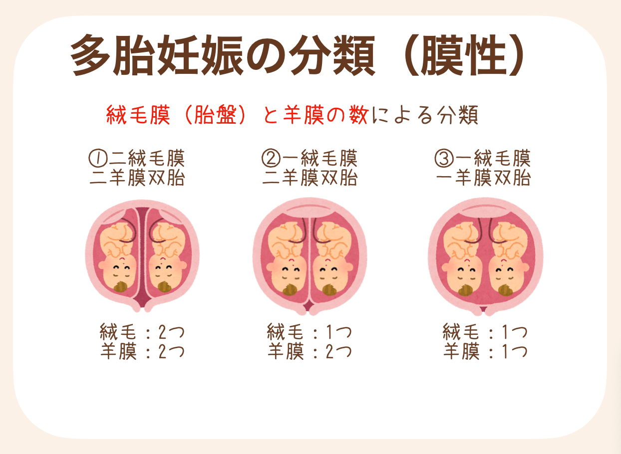 多胎 妊娠 と は