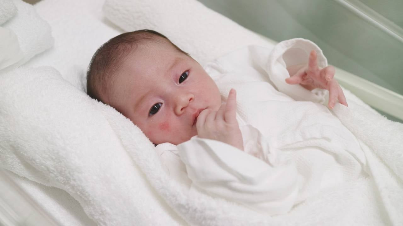 新生児のアトピー性皮膚炎の基本的な特徴と、よく似た症状である乳児湿疹との違いについて解説します