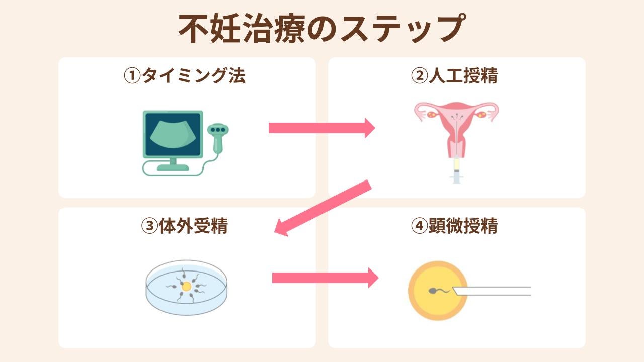 不妊治療は、タイミング法・人工授精・体外受精・顕微授精、の順で進めます