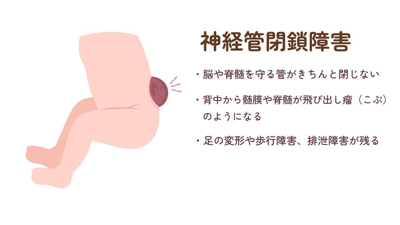 ç¥çµç®¡ééé害ãšã¯è³ãèé«ãå®ã管ããã¡ããšéããã«èµ·ããé害ã®ããš