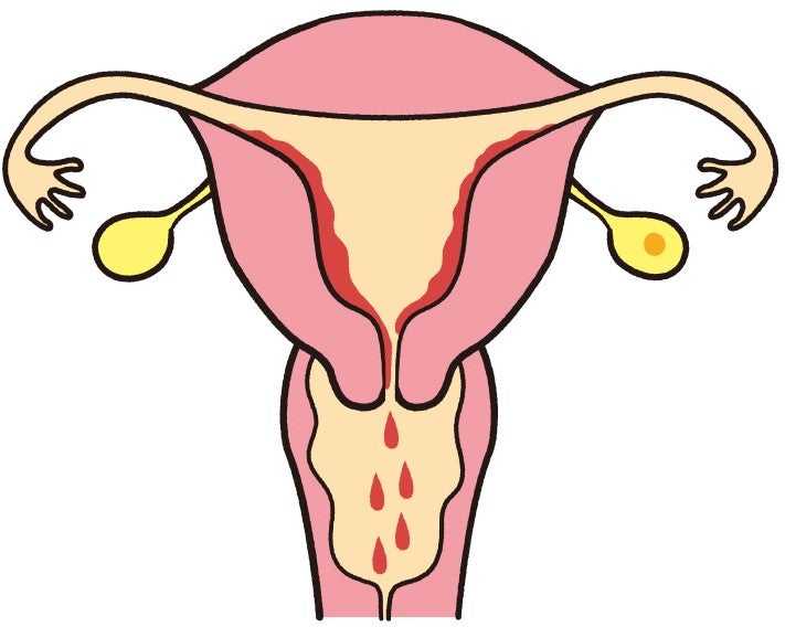 妊娠が成立しなかったときに、子宮の中に作られていた内膜がはがれて体の外に出てきます。これが月経（生理）です。