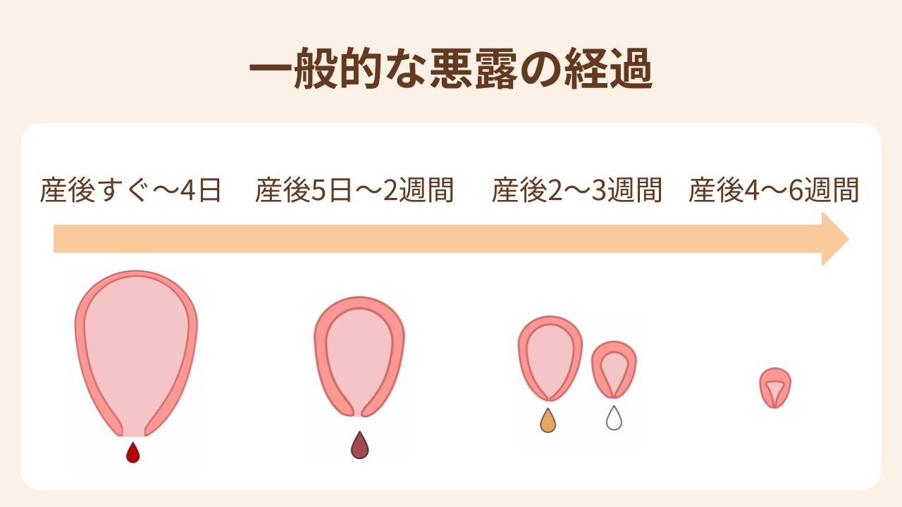 悪 露 と は