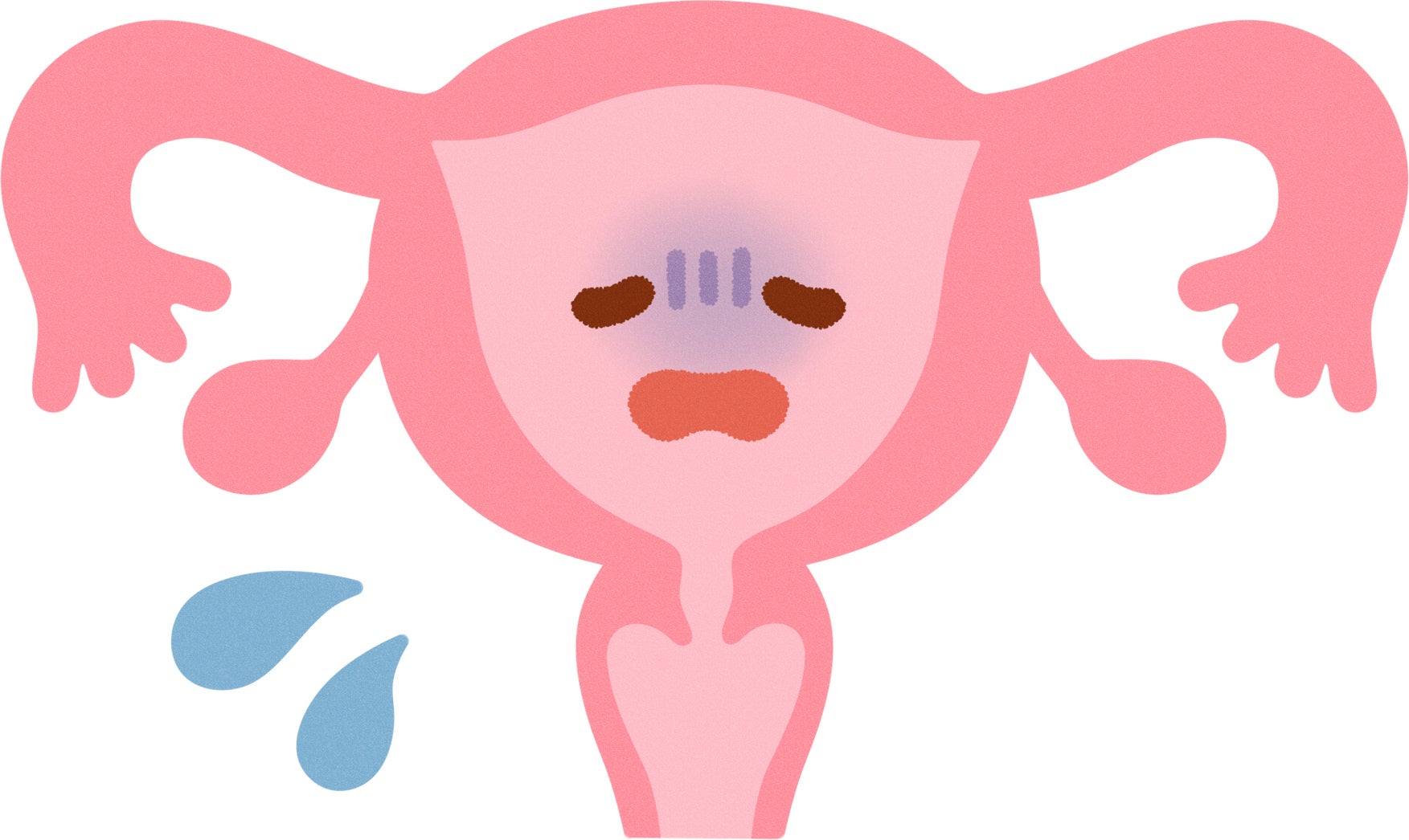 産後初めての生理がしんどい原因5つ：5.婦人科系の病気