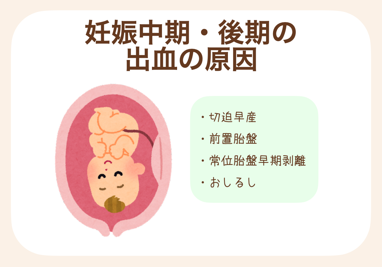 切迫早産、前置胎盤、常位胎盤早期剥離、おしるし
