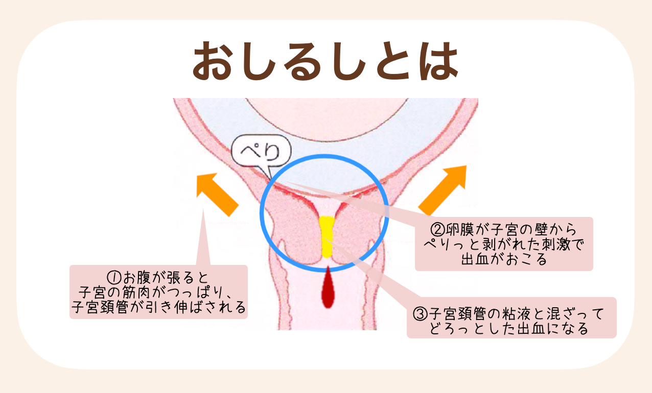 おしるしとは、出産が近づいて子宮口が開く準備をすることで起こる生理的な出血のこと