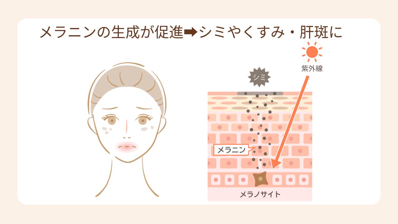 妊娠中はメラニンの生成が促されるため、シミやくすみができやすい