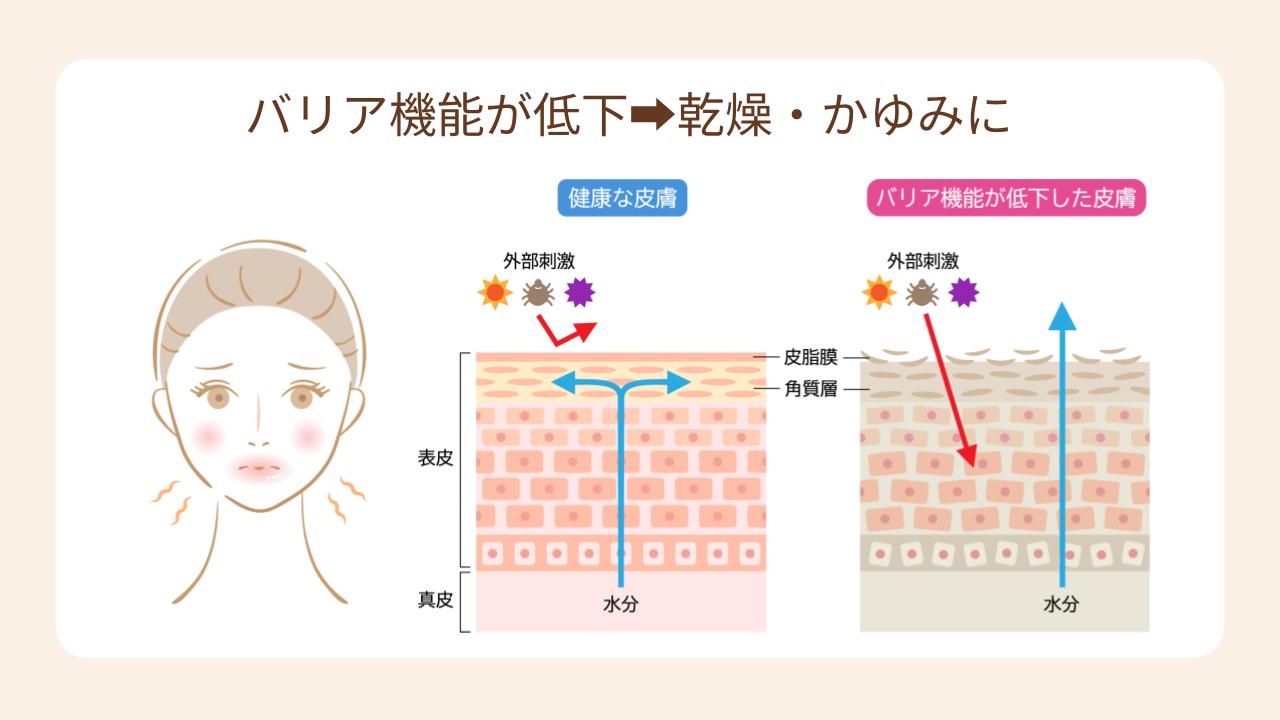 妊娠中はバリア機能が低下し、乾燥・かゆみを引き起こしやすい