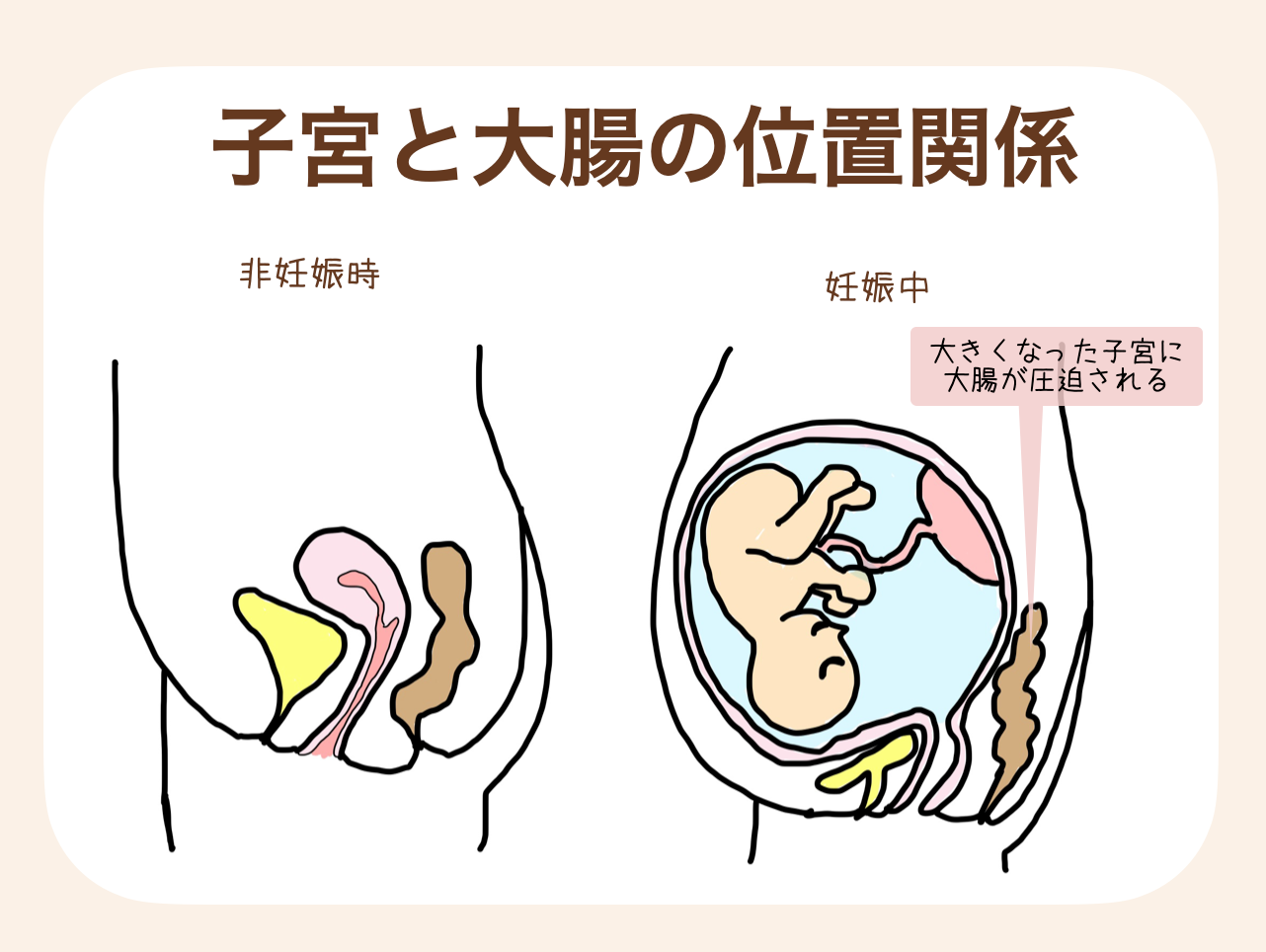 大腸は子宮のうしろに位置している