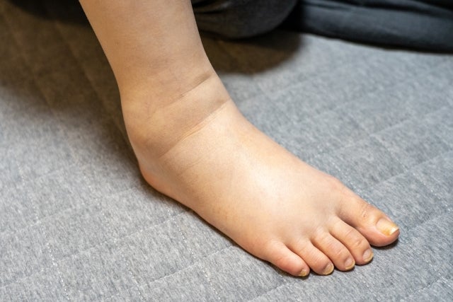 妊婦は子宮が大きくなるにつれて足の血管が圧迫されるため、血行不良になりやすい