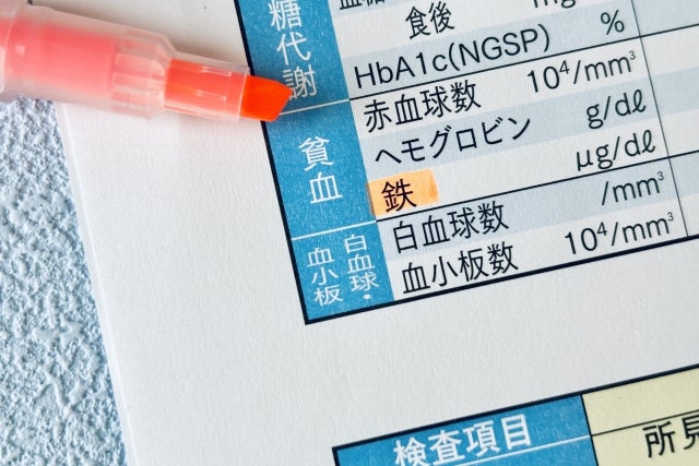 貧血の検査項目「鉄」