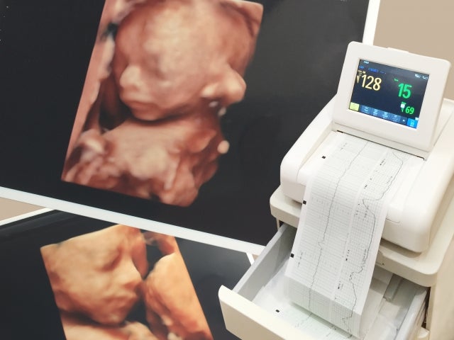 定期的に妊婦健診を受けましょう。