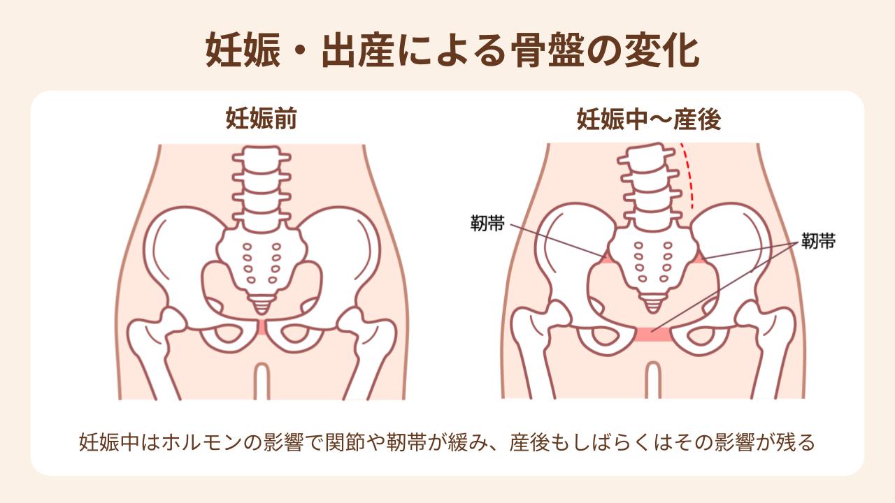 妊娠・出産で骨盤まわりの関節や靭帯が緩み、その影響は産後もしばらく続く