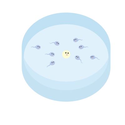 卵子と精子を体から取り出して、体外で受精を行います。受精