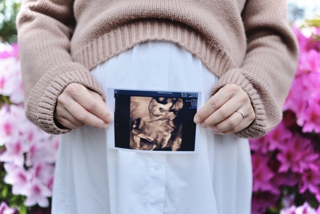 葉酸は、妊娠時期によって目安摂取量が変わります。