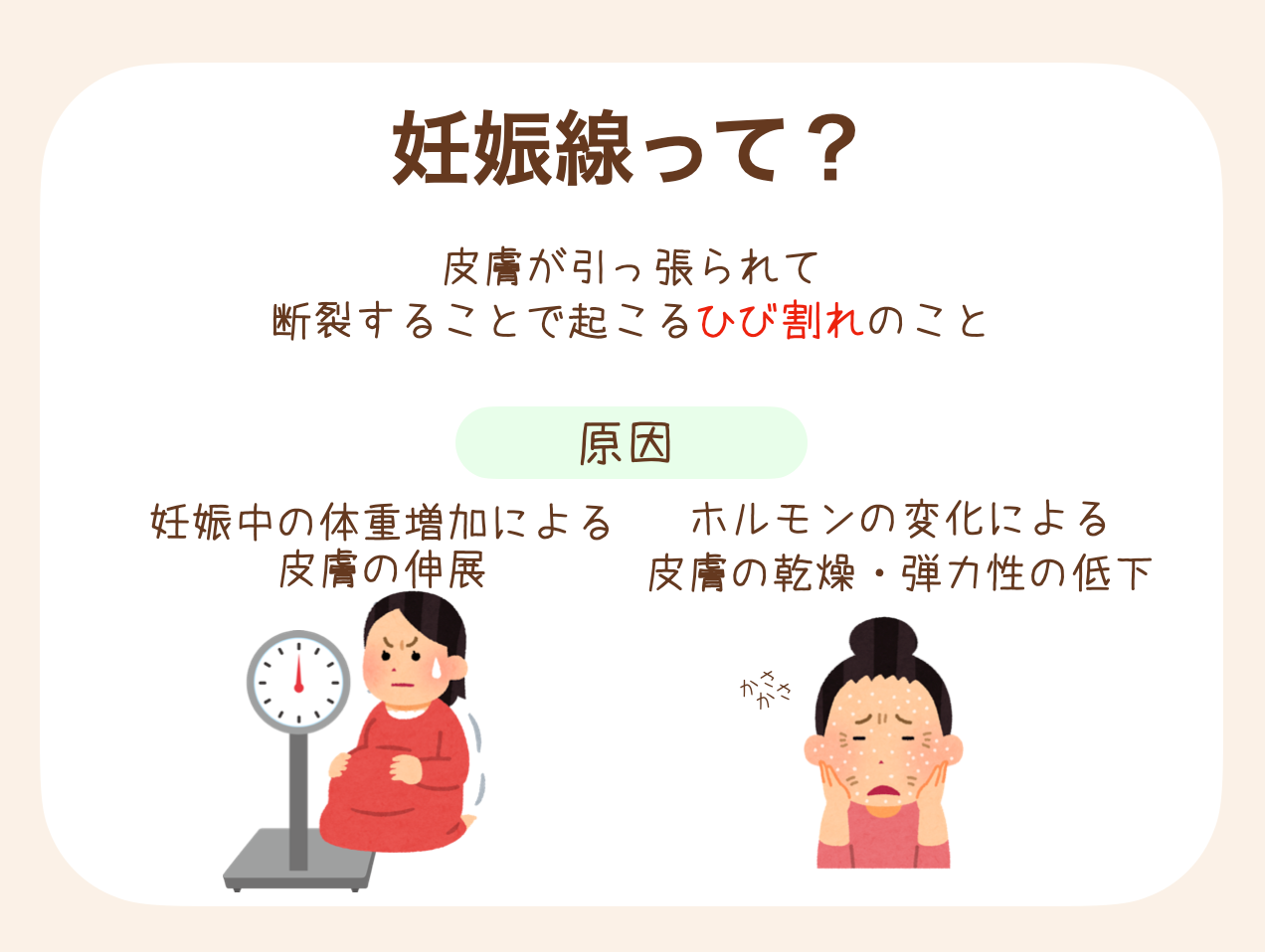 妊娠による体重増加や、ホルモンの変化による皮膚の乾燥・弾力性の低下によって、皮膚が引っ張られて断裂することで起こるひび割れのこと