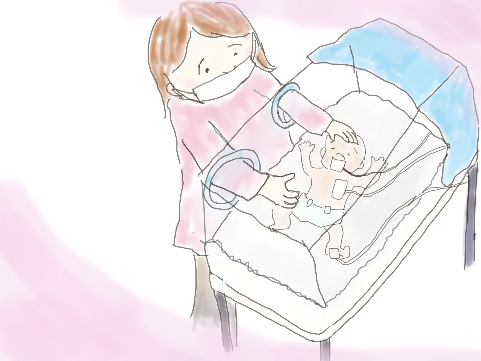 双子の妊娠にはさまざまなリスクがある：1.早産