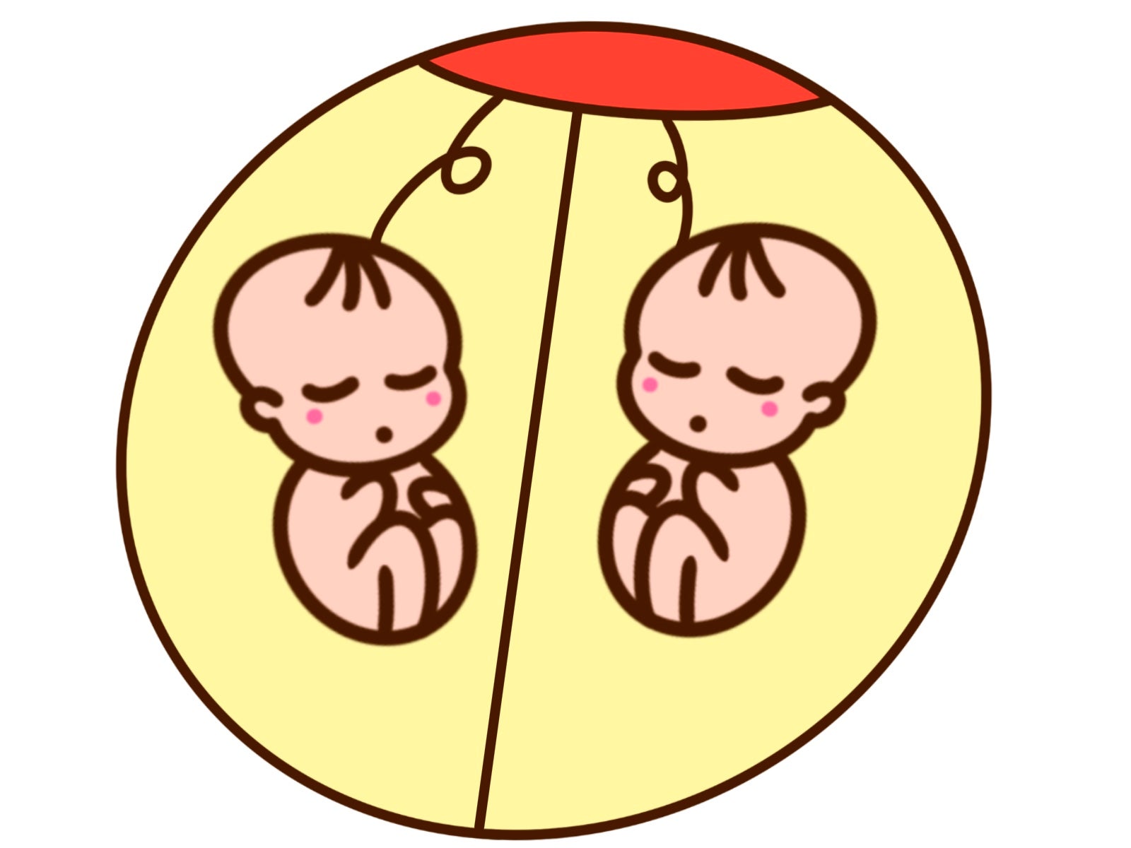 双子の妊娠にはさまざまなリスクがある：4. 胎児発育不全