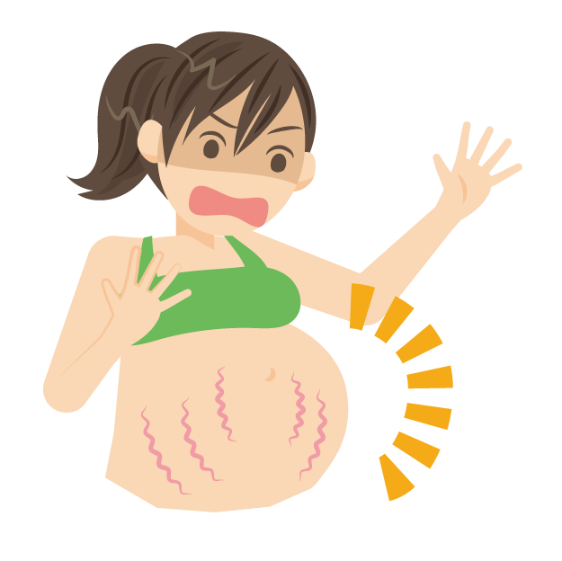 妊娠線ができやすい人の特徴