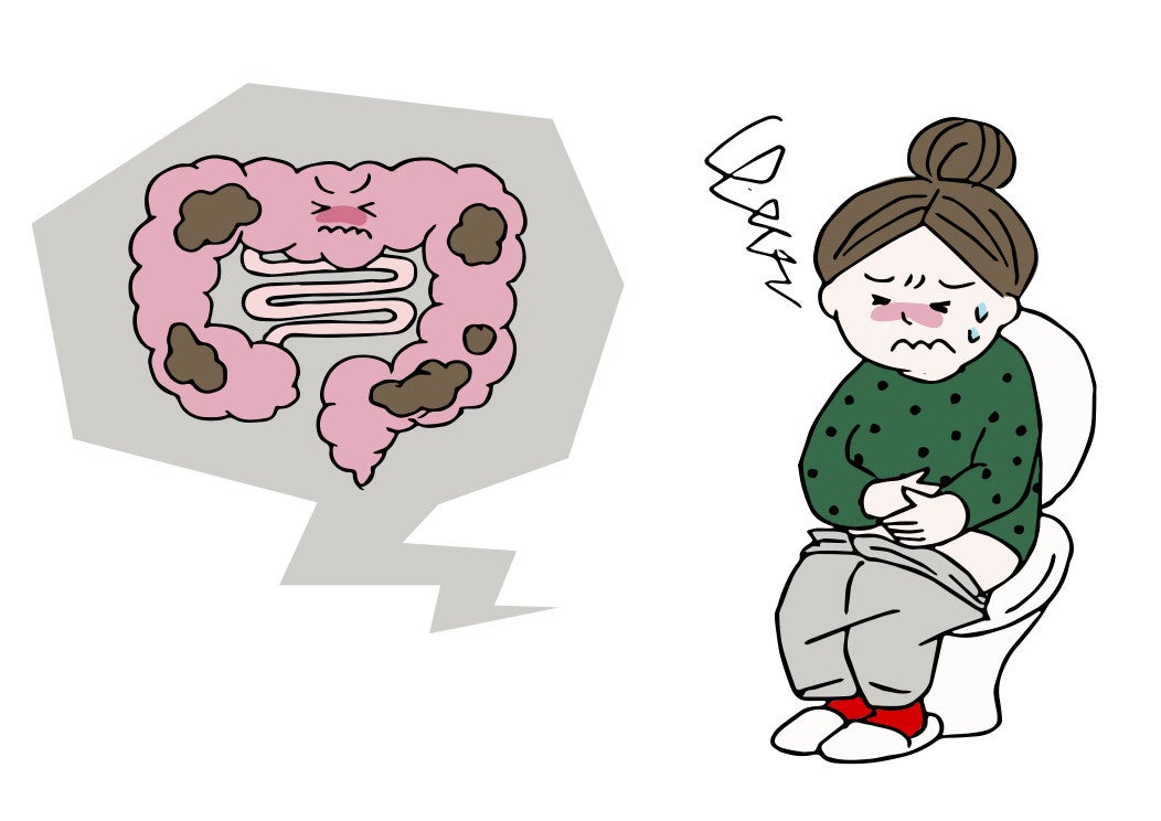 産後は、体の変化や生活リズムの変化などから、便秘になりやすい時期です。まずは、産後に便秘になりやすい主な原因を5つ紹介します。  ①骨盤底筋のゆるみ ②会陰切開や傷の痛み ③ホルモンバランスや自律神経の乱れ ④水分不足 ⑤食事や運動量の変化